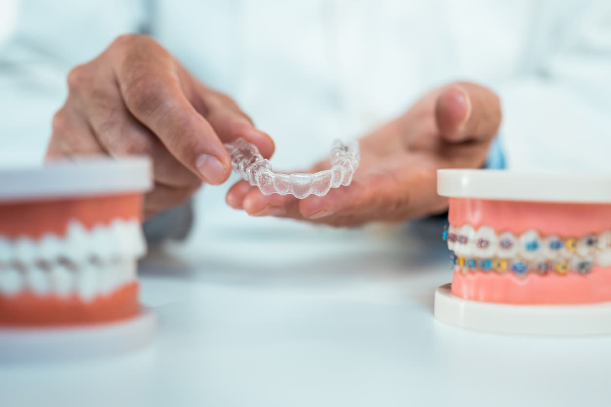 Transparenter Aligner zwischen zwei Kiefermodellen, rechts eines mit fester Zahnspange - Vergleich der Zahnbegradigung, Zahnarztpraxis Dr. Salem in Krefeld-Traar